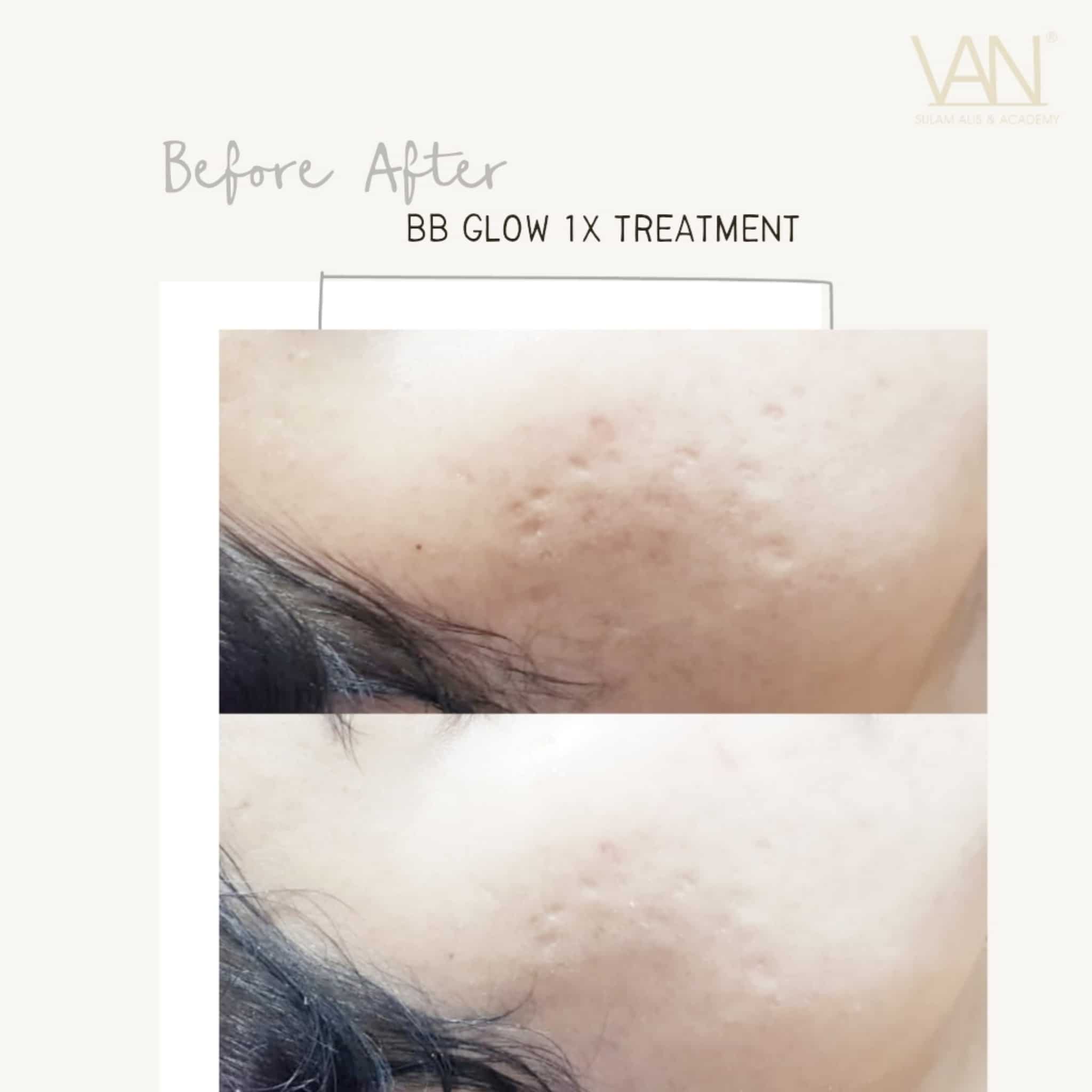 Hasil Sulam Wajah di VAN Sulam Alis
